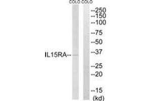 Image no. 1 for anti-Interleukin 15 Receptor, alpha (IL15RA) (AA 99-148) antibody (ABIN1535507)