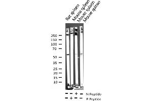Image no. 2 for anti-Lymphocyte-Specific Protein tyrosine Kinase (LCK) (pTyr393) antibody (ABIN6256726)