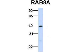 Image no. 3 for anti-RAB8A, Member RAS Oncogene Family (RAB8A) (Middle Region) antibody (ABIN2792290)