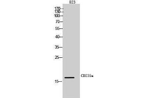 Image no. 1 for anti-Glycophorin A (GYPA) (Internal Region) antibody (ABIN3181476)