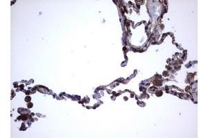 Image no. 10 for anti-Tumor Necrosis Factor Receptor Superfamily, Member 8 (TNFRSF8) (AA 19-379) antibody (ABIN1491084)