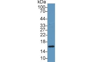 Image no. 2 for anti-Retinol Binding Protein 5, Cellular (RBP5) (AA 1-135) antibody (ABIN1078488)