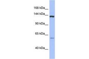 DHX34 Antikörper  (C-Term)