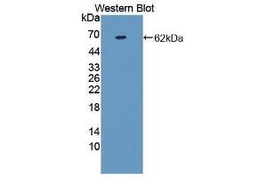 Image no. 1 for anti-Prothrombin Fragment 1+2,F1+2 (AA 44-327) antibody (ABIN1173462)