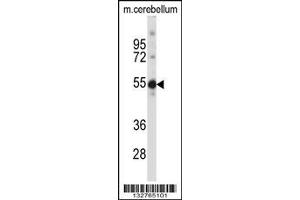 Image no. 1 for anti-TSPY-Like 5 (TSPYL5) (AA 344-372), (C-Term) antibody (ABIN657506)