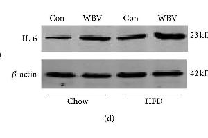 Image no. 6 for anti-Interleukin 6 (IL6) (AA 111-150) antibody (ABIN728083)