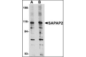 Image no. 1 for anti-Discs, Large (Drosophila) Homolog-Associated Protein 2 (DLGAP2) (Center) antibody (ABIN500654)