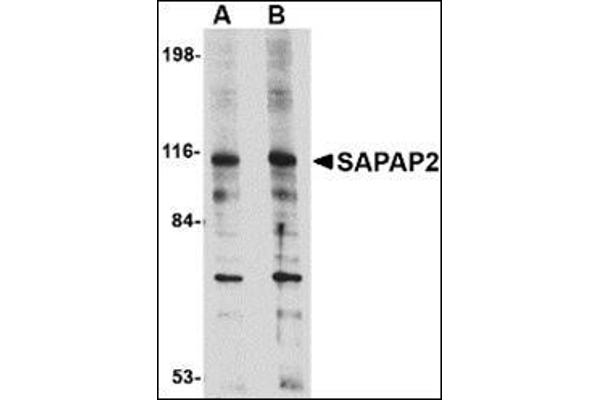 anti-Discs, Large (Drosophila) Homolog-Associated Protein 2 (DLGAP2) (Center) antibody