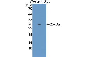 Image no. 1 for anti-Cytoglobin (CYGB) (AA 1-190) antibody (ABIN1867480)