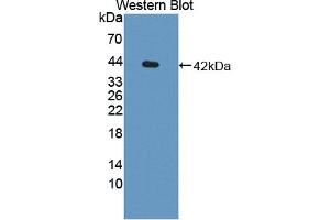 anti-Killer Cell Immunoglobulin-Like Receptor, Two Domains, Long Cytoplasmic Tail, 5A (KIR2DL5A) (AA 22-375) antibody