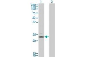 Image no. 1 for anti-Interleukin 24 (IL24) (AA 159-171) antibody (ABIN957373)