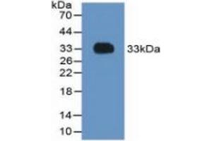 Image no. 3 for Coagulation Factor II (thrombin) (F2) ELISA Kit (ABIN6574219)