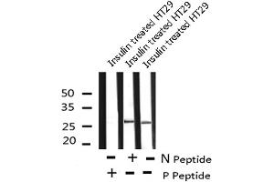 Image no. 6 for anti-Caveolin 2 (CAV2) (pSer36) antibody (ABIN6271376)