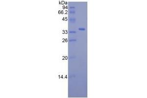 Image no. 1 for Retinol Binding Protein 3, Interstitial (RBP3) protein (ABIN3011482)