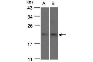Image no. 3 for anti-Sorting Nexin 12 (SNX12) (C-Term) antibody (ABIN2856383)