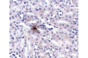 Image no. 2 for anti-Solute Carrier Family 39 (Metal Ion Transporter), Member 11 (SLC39A11) (Internal Region) antibody (ABIN6656536)