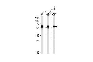 Image no. 2 for anti-Golgi-Associated PDZ and Coiled-Coil Motif Containing (GOPC) antibody (ABIN5536182)