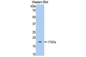 Image no. 1 for anti-Complement Factor B (CFB) (AA 477-600) antibody (ABIN1858375)