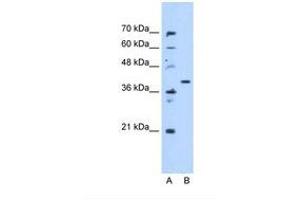 Image no. 1 for anti-Enoyl CoA Hydratase Domain Containing 3 (ECHDC3) (AA 71-120) antibody (ABIN341636)