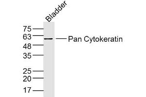 Image no. 2 for anti-Keratin 1 (KRT1) (AA 141-240) antibody (ABIN733343)