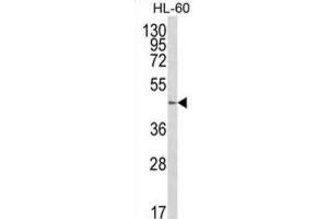 Image no. 1 for anti-UDP-Gal:betaGlcNAc beta 1,4 Galactosyltransferase, Polypeptide 1 (B4GALT1) antibody (ABIN3003951)