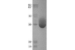 Chymotrypsin Protein (CTRL)