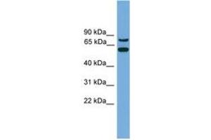 Image no. 1 for anti-YY1 Associated Protein 1 (YY1AP1) (C-Term) antibody (ABIN6744896)