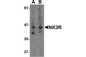 Western Blotting (WB) image for anti-Tachykinin Receptor 3 (TACR3) (Middle Region) antibody (ABIN1031019)