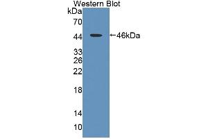Image no. 1 for anti-Ladinin 1 (LAD1) (AA 1-140) antibody (ABIN5013847)