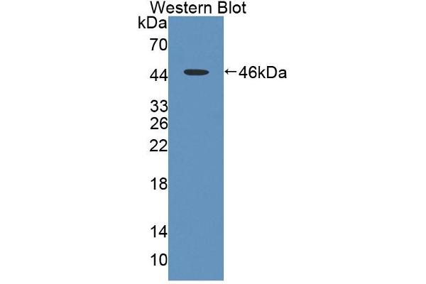 Ladinin 1 antibody  (AA 1-140)
