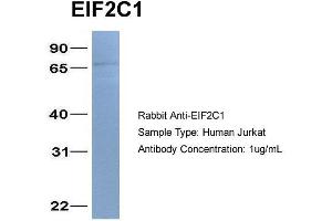 Image no. 1 for anti-Eukaryotic Translation Initiation Factor 2C, 1 (EIF2C1) (N-Term) antibody (ABIN2785928)