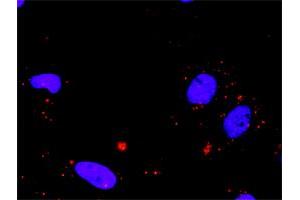 Proximity Ligation Assay (PLA) image for MAX & SMAD3 Protein Protein Interaction Antibody Pair (ABIN1340149)