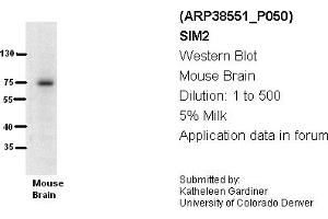 Image no. 1 for anti-Single-Minded Homolog 2 (SIM2) (N-Term) antibody (ABIN2780639)