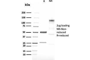 Image no. 1 for anti-LIM Domain Only 2 (Rhombotin-Like 1) (LMO2) (AA 23-140) antibody (ABIN6939968)