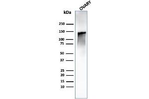 anti-Caldesmon 1 (CALD1) antibody