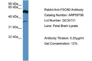 Image no. 2 for anti-Fascin 2 (FSCN2) (Middle Region) antibody (ABIN2788215)