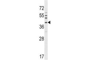 Image no. 2 for anti-NK6 Homeobox 1 (NKX6-1) (AA 285-314) antibody (ABIN3028877)