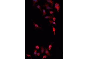 Image no. 3 for anti-V-Akt Murine Thymoma Viral Oncogene Homolog 1 (AKT1) antibody (ABIN6259867)