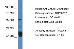 Image no. 1 for anti-Janus Kinase and Microtubule Interacting Protein 2 (JAKMIP2) (C-Term) antibody (ABIN2788569)