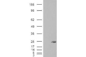 Image no. 1 for anti-SAR1 Homolog B (SAR1B) (Internal Region) antibody (ABIN334486)