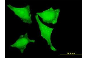 Immunofluorescence of monoclonal antibody to LMO3 on HeLa cell.