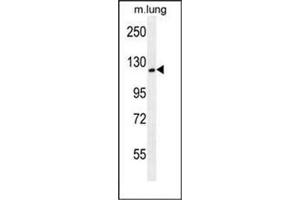 Western blot analysis of CYTSA Antibody (N-term) in Mouse lung tissue lysates (35ug/lane).