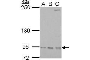 WB Image RRM1 antibody detects RRM1 protein by Western blot analysis.