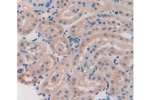 Image no. 2 for anti-Tissue Specific Transplantation Antigen P35B (TSTA3) (AA 1-321) antibody (ABIN5014406)