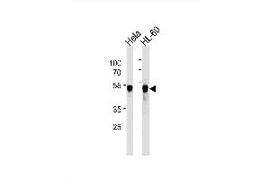 Image no. 1 for anti-Vaccinia Related Kinase 1 (VRK1) antibody (ABIN1882291)