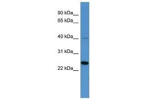 Image no. 1 for anti-MAS-Related GPR, Member X3 (MRGPRX3) (C-Term) antibody (ABIN929389)