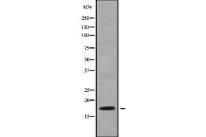 Image no. 1 for anti-NADH Dehydrogenase (Ubiquinone) 1 alpha Subcomplex, 6, 14kDa (NDUFA6) (Internal Region) antibody (ABIN6263561)