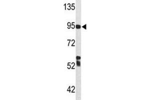 Image no. 2 for anti-Complement Component C7 (C7) (AA 375-403) antibody (ABIN3029694)