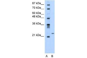 Image no. 2 for anti-Polyamine Modulated Factor 1 (PMF1) (Middle Region) antibody (ABIN1108674)