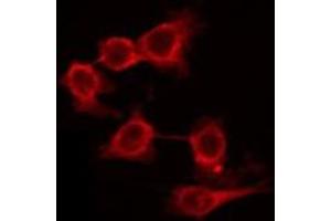 Image no. 3 for anti-Glutamate Receptor, Metabotropic 7 (GRM7) antibody (ABIN6263242)
